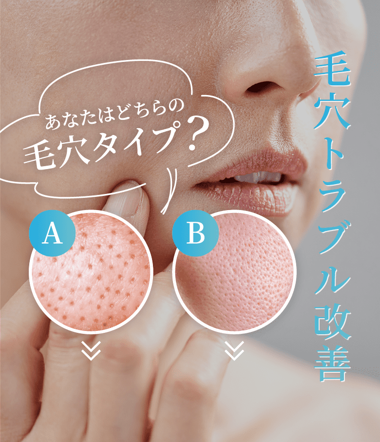 毛穴トラブル改善