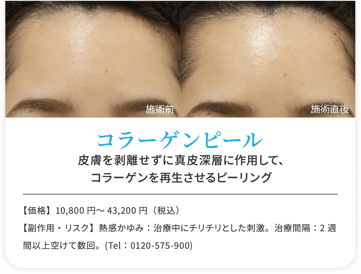 コラーゲンピール