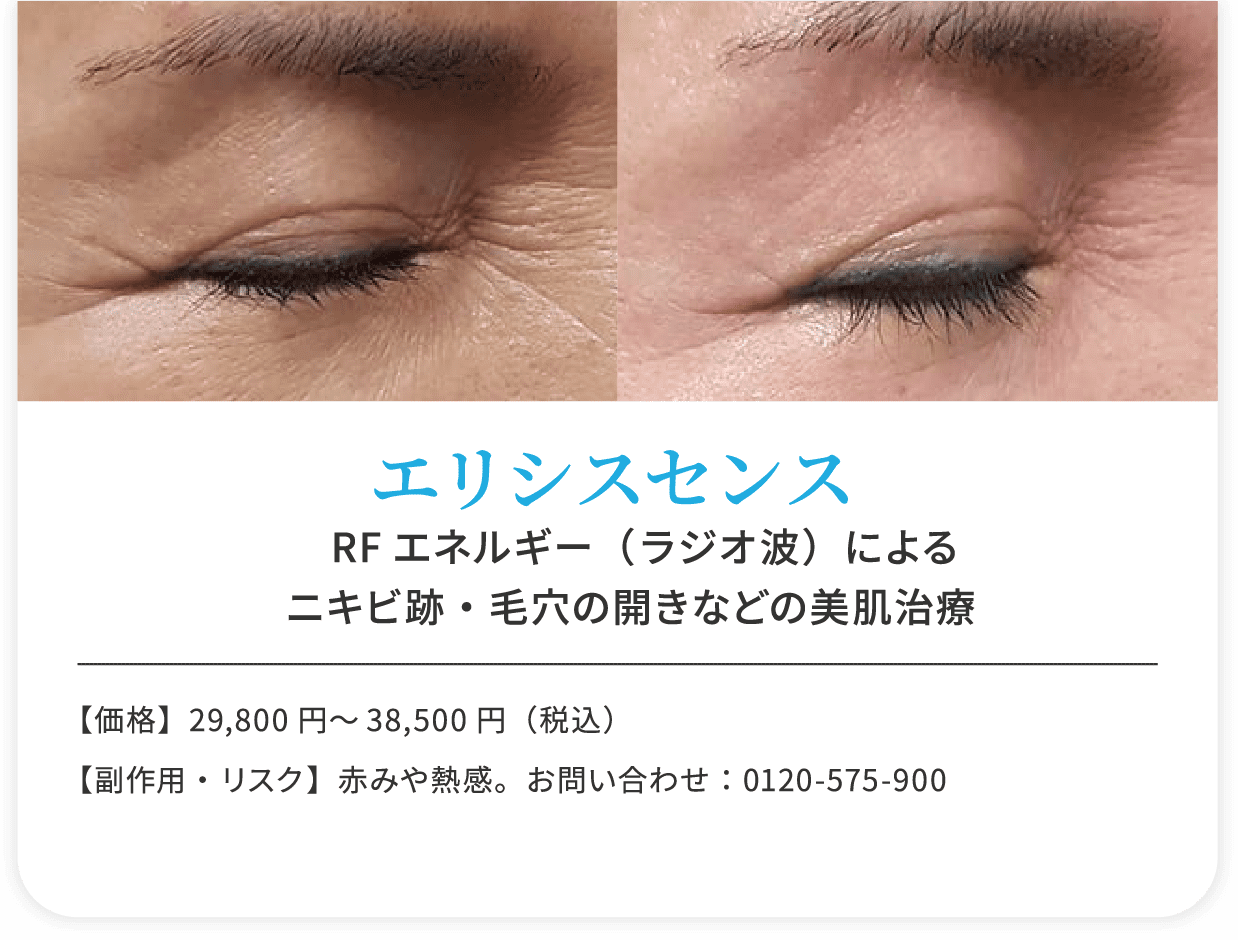 エリシスセンス