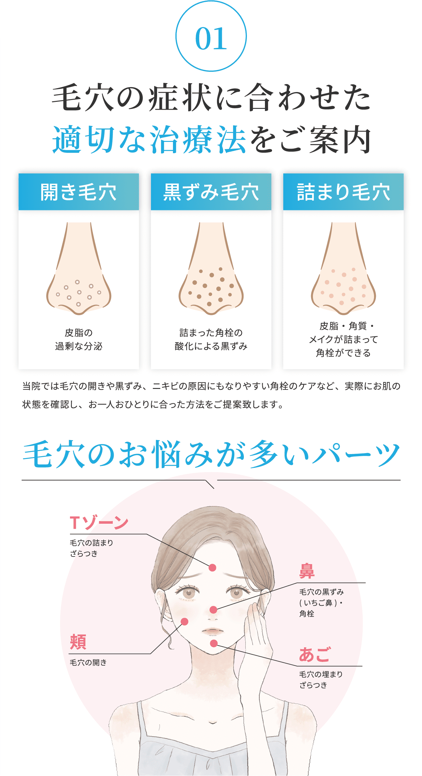 毛穴の症状に合わせた適切な治療法をご案内