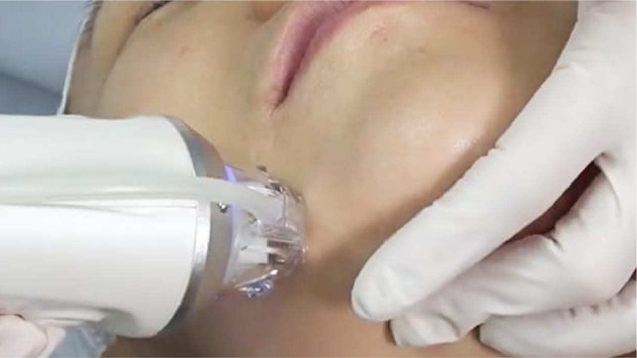 ピッタリと密着・真空バキューム機能