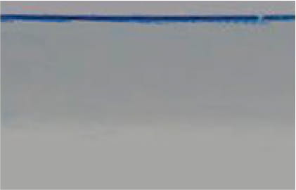 一般マイクロニードル